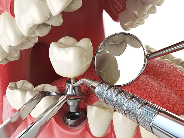 Best Emergency Gum Treatment in Galena Park, TX
